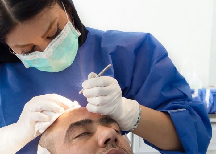 العلاج في الأردن – زراعة الشعر