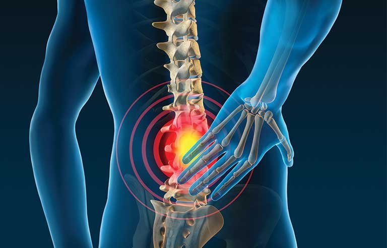 العلاج في الأردن – علاج العظام والمفاصل
